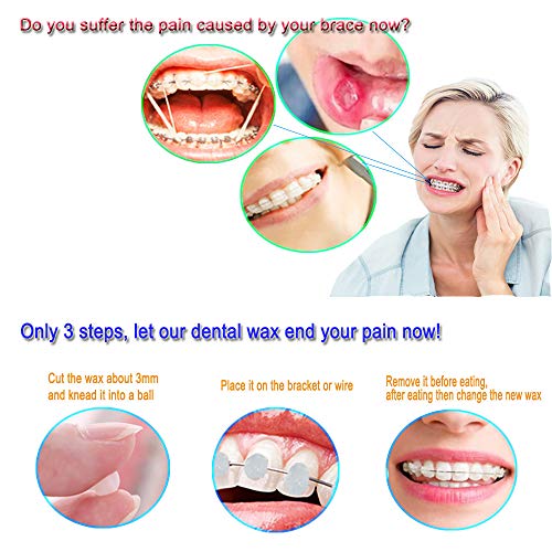 Parantez Takan için EvaGO Diş Bakımı Ortodontik Balmumu, 10 Paket